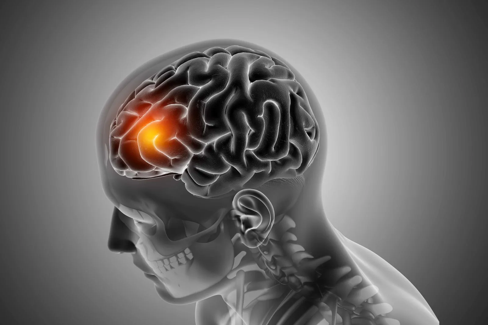 dano cerebral confabulaciones | Neurita