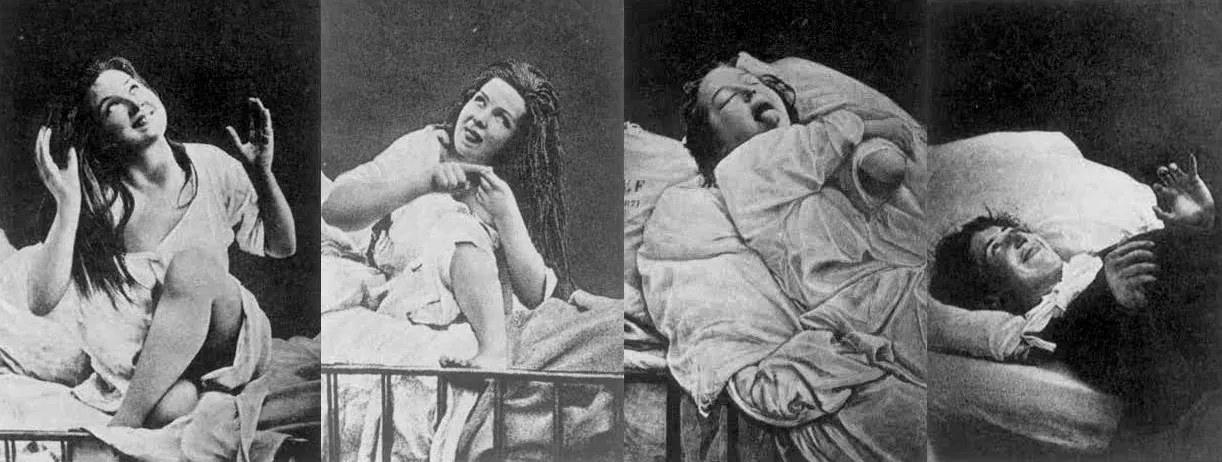 hysteria | Neurita
