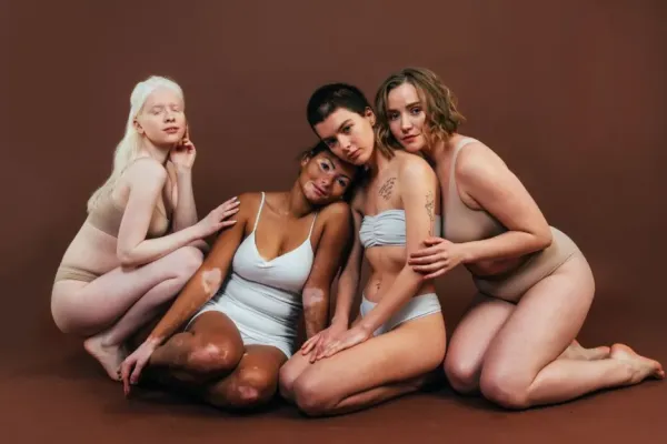 Body shaming, cuando se burlan de tu cuerpo 6 que es body shaming gordofobia fatorexia psicologia neurita blog psicologa
