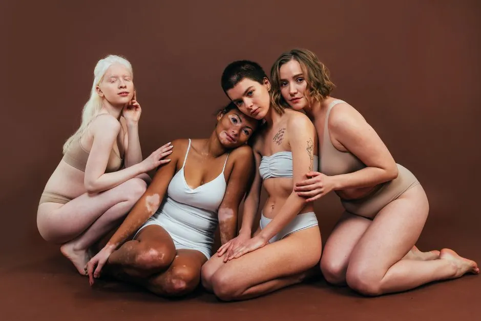 Body shaming, cuando se burlan de tu cuerpo 1 que es body shaming gordofobia fatorexia psicologia neurita blog psicologa