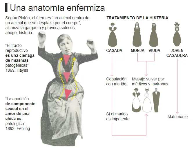tatamiento histeria | Neurita